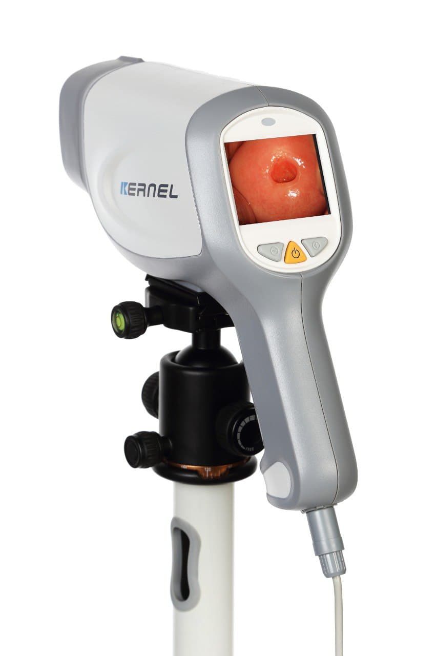 Кольпоскоп — діагностичне обладнання